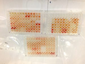 The samples are mixed with various reagents, and a colour change can be seen. The intensity of the colour is measured and compared to a reference range. The level of colour change indicates the density of antibodies bound to the plate and is used to gauge the immune response to tuberculin.